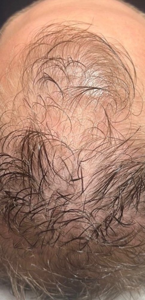 Before Root Authority treatment, crown area