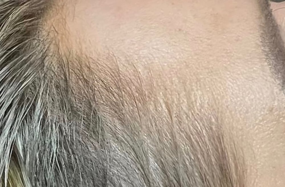After Root Authority treatment, temple