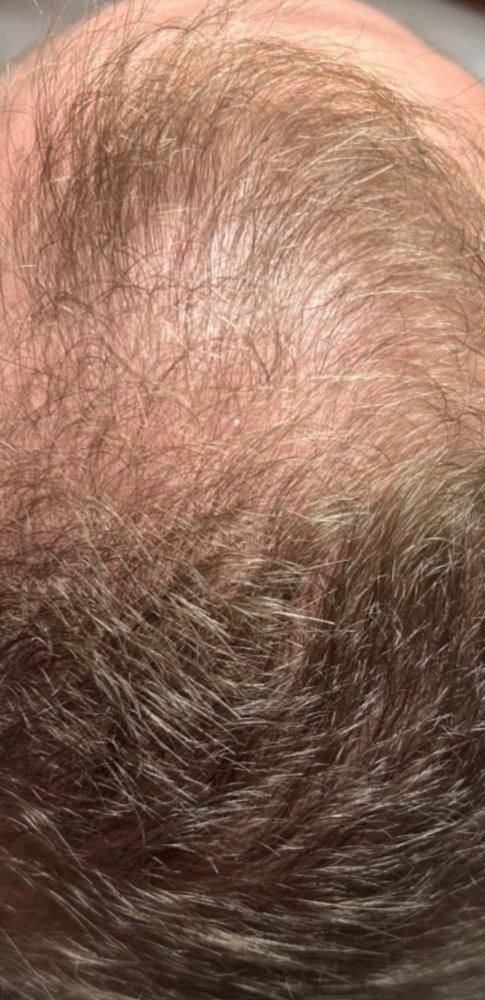 After Root Authority treatment, crown area