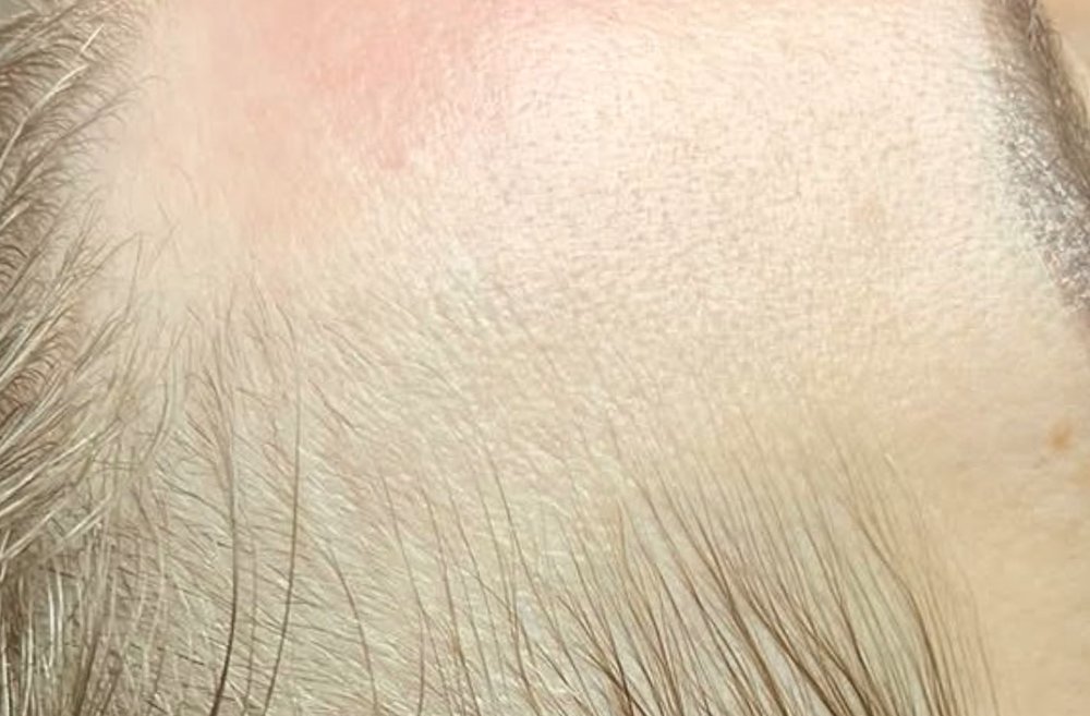 Before Root Authority treatment, temple
