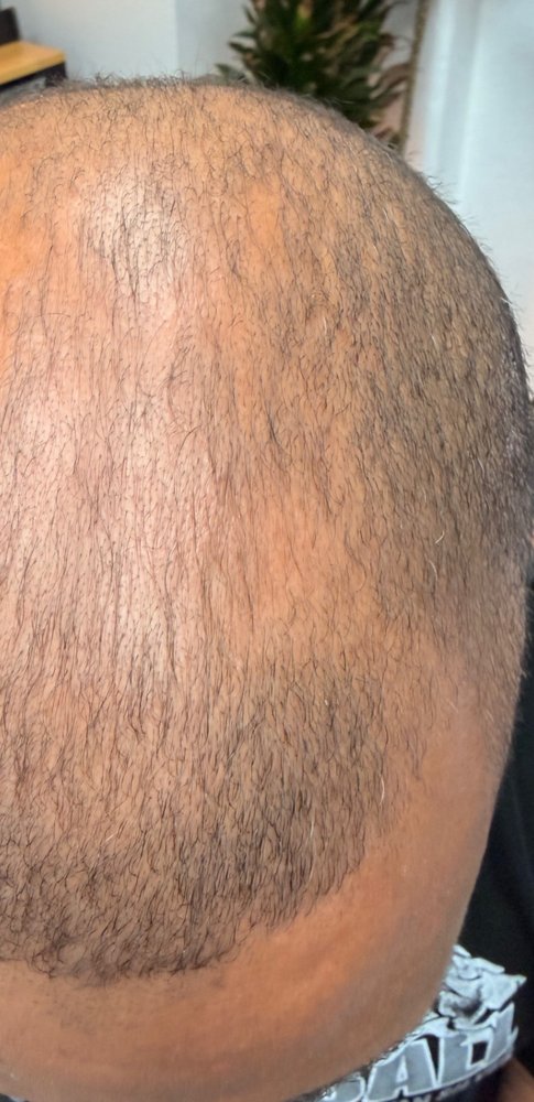 After Root Authority treatment, top of scalp