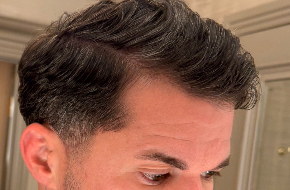 After Root Authority treatment, hairline